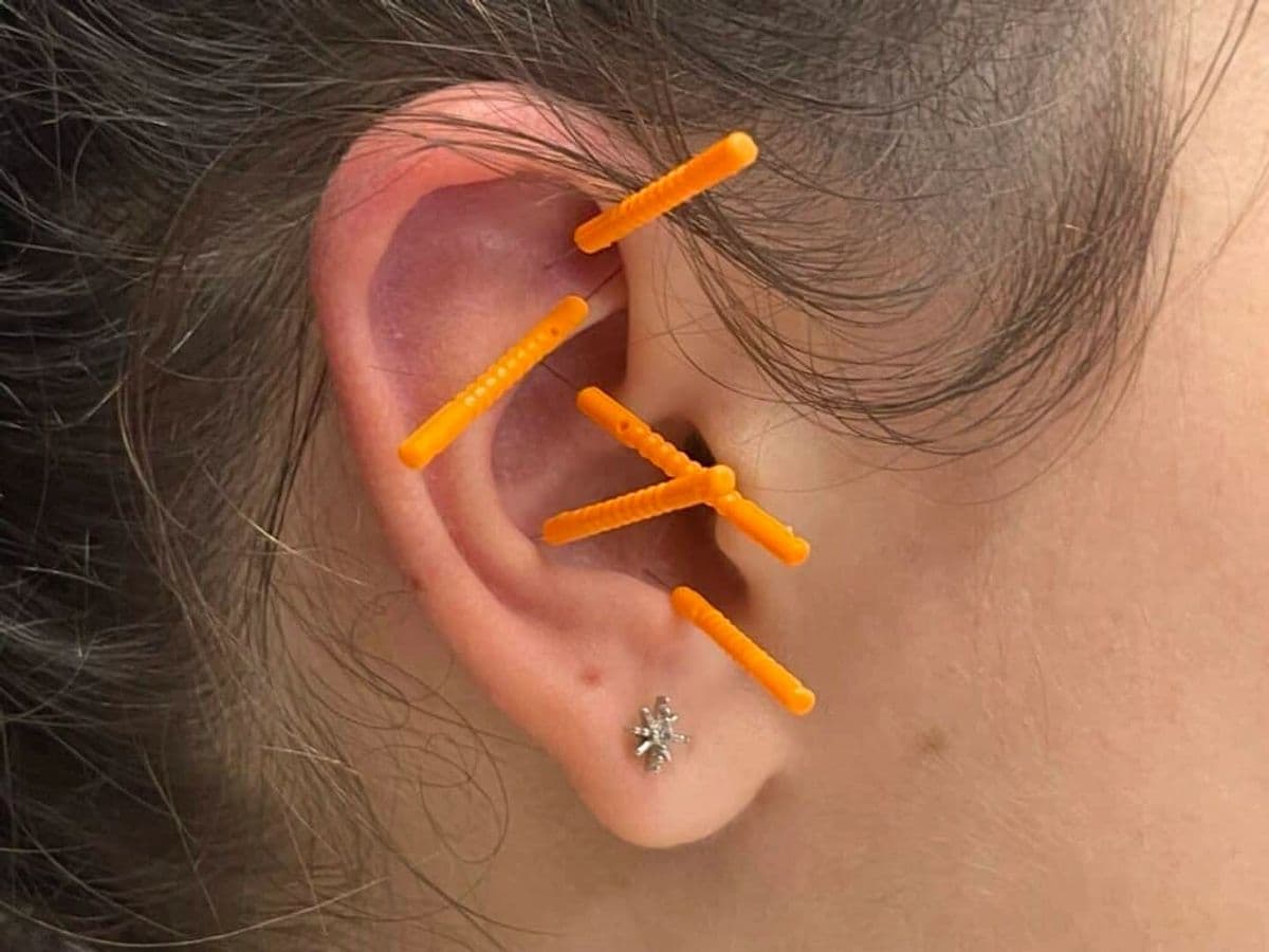 AcuDetox ear acupuncture points